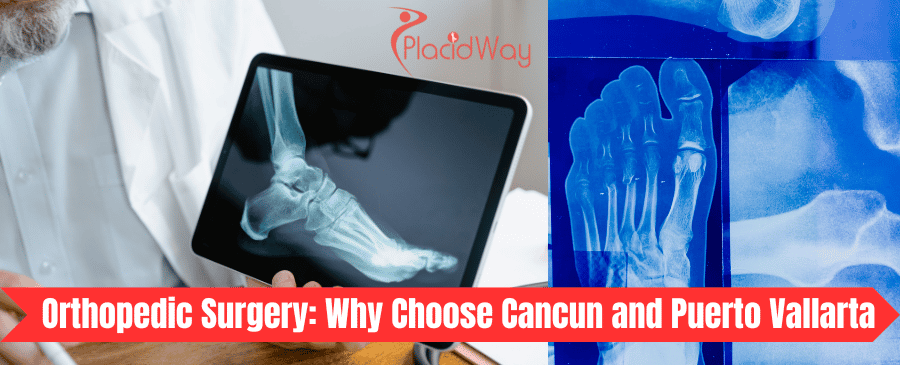 Cirugía Ortopédica en Cancún y Puerto Vallarta