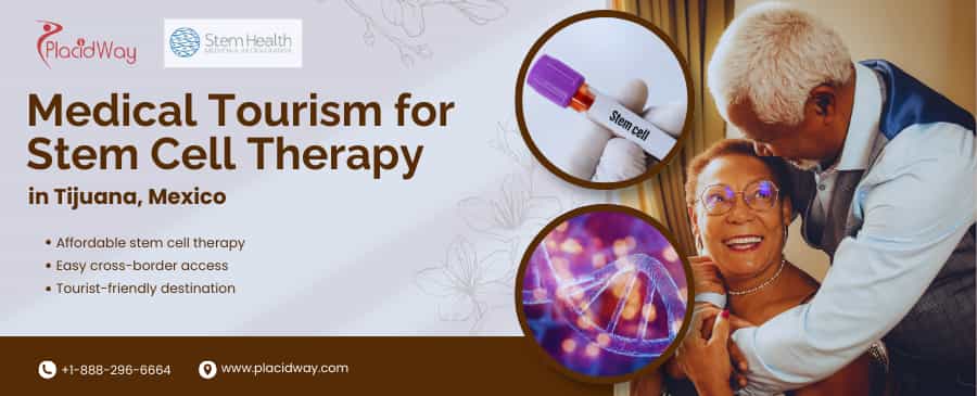 Terapia con células madre en el turismo médico de Tijuana