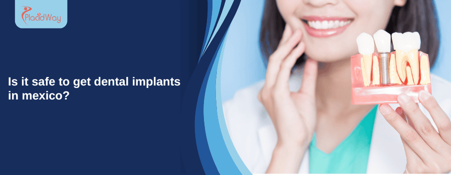 Dental implants in Mexico