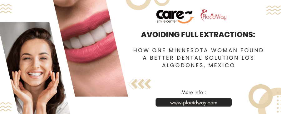 Avoiding Full Extractions: How One Minnesota Woman Found a Better Dental Solution Los Algodones, Mexico