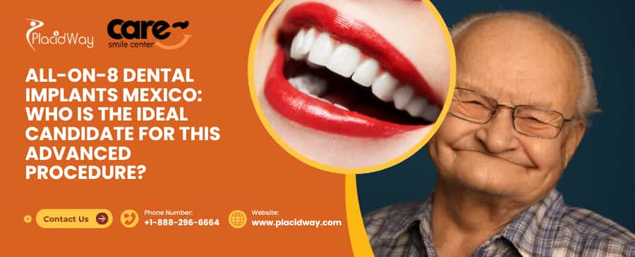 All-on-8 Dental Implants Mexico: Who Is the Ideal Candidate for This Advanced Procedure?