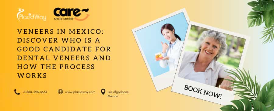 4-Veneers in Mexico Discover Who Is a Good Candidate for Dental Veneers and How the Process Works