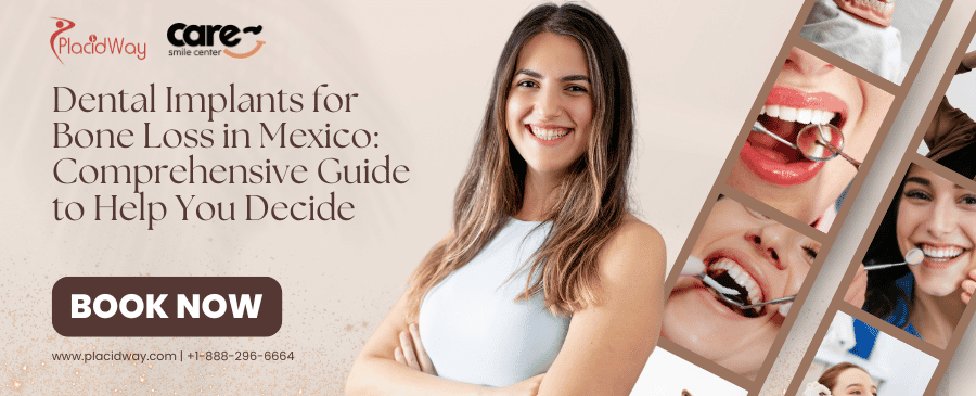 Dental Implants for Bone Loss in Mexico: Comprehensive Guide to Help You Decide