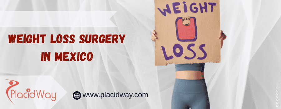 weight loss surgery in Mexico
