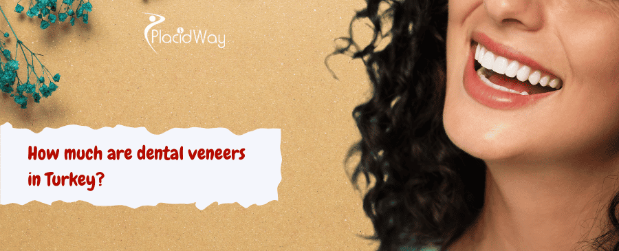 dental veneers in turkey