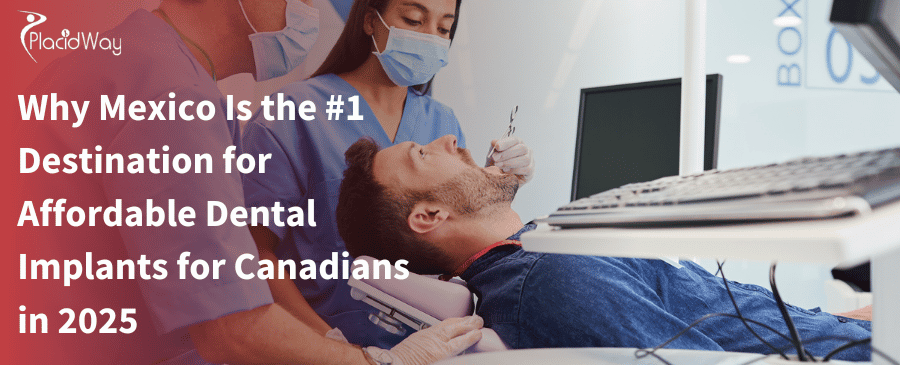 ¿Por qué México es el destino número uno para implantes dentales asequibles para canadienses en 2025?