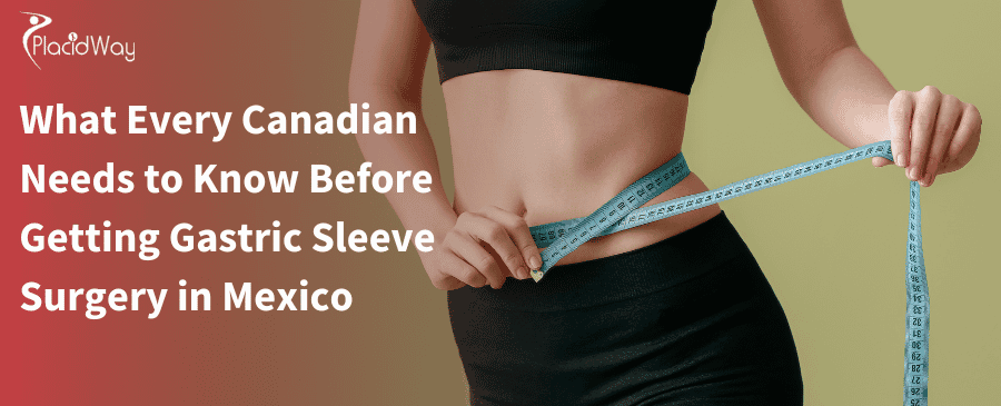 Canadian Needs to Know Before Getting Gastric Sleeve Surgery in Mexico