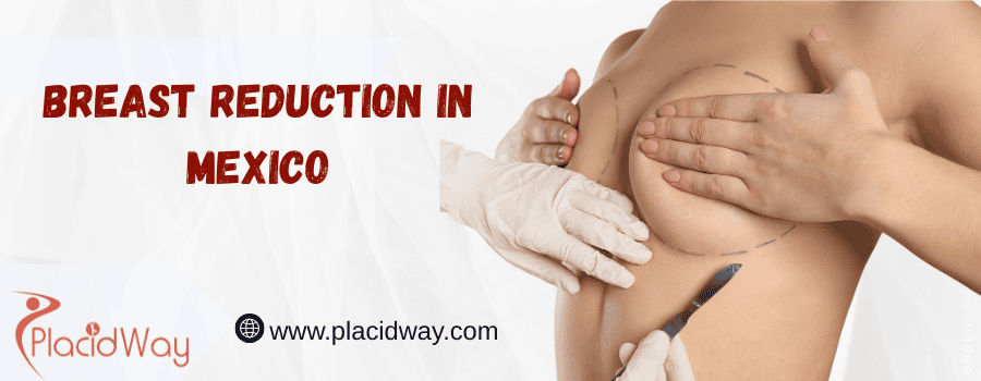 breast reduction in Mexico