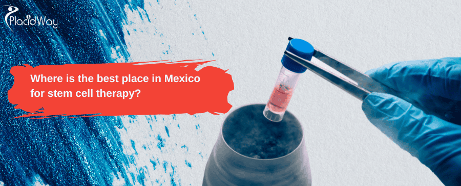 El mejor lugar en México para la terapia con células madre