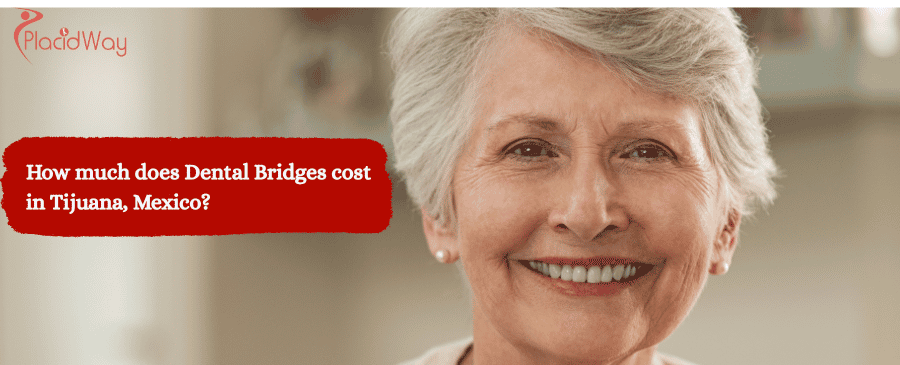 Dental Bridge in Tijuana