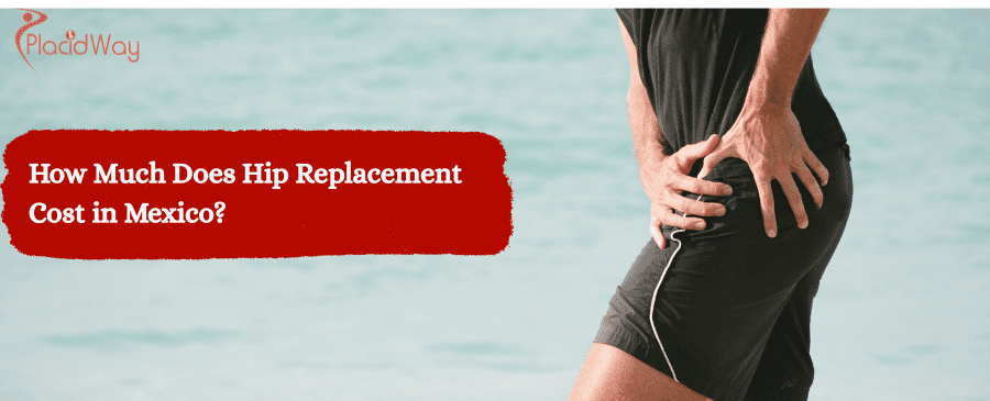 Hip Replacement Cost in Mexico
