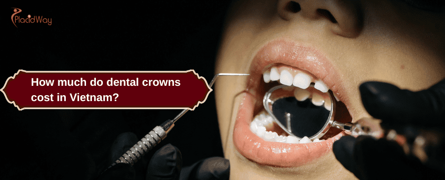 dental crowns cost in Vietnam