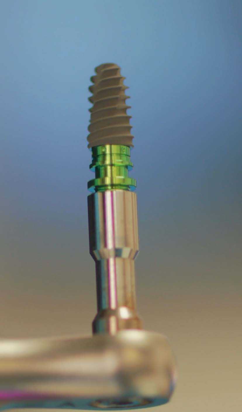 Mexican Dental Implants