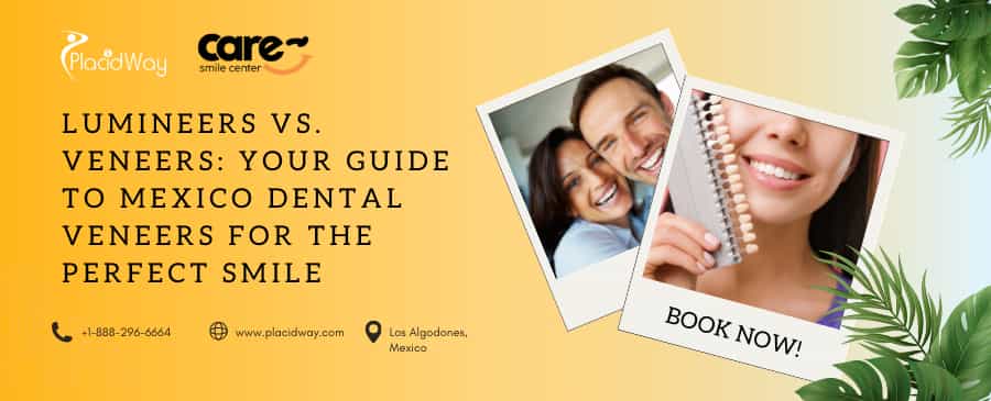 Mexico Dental Veneers