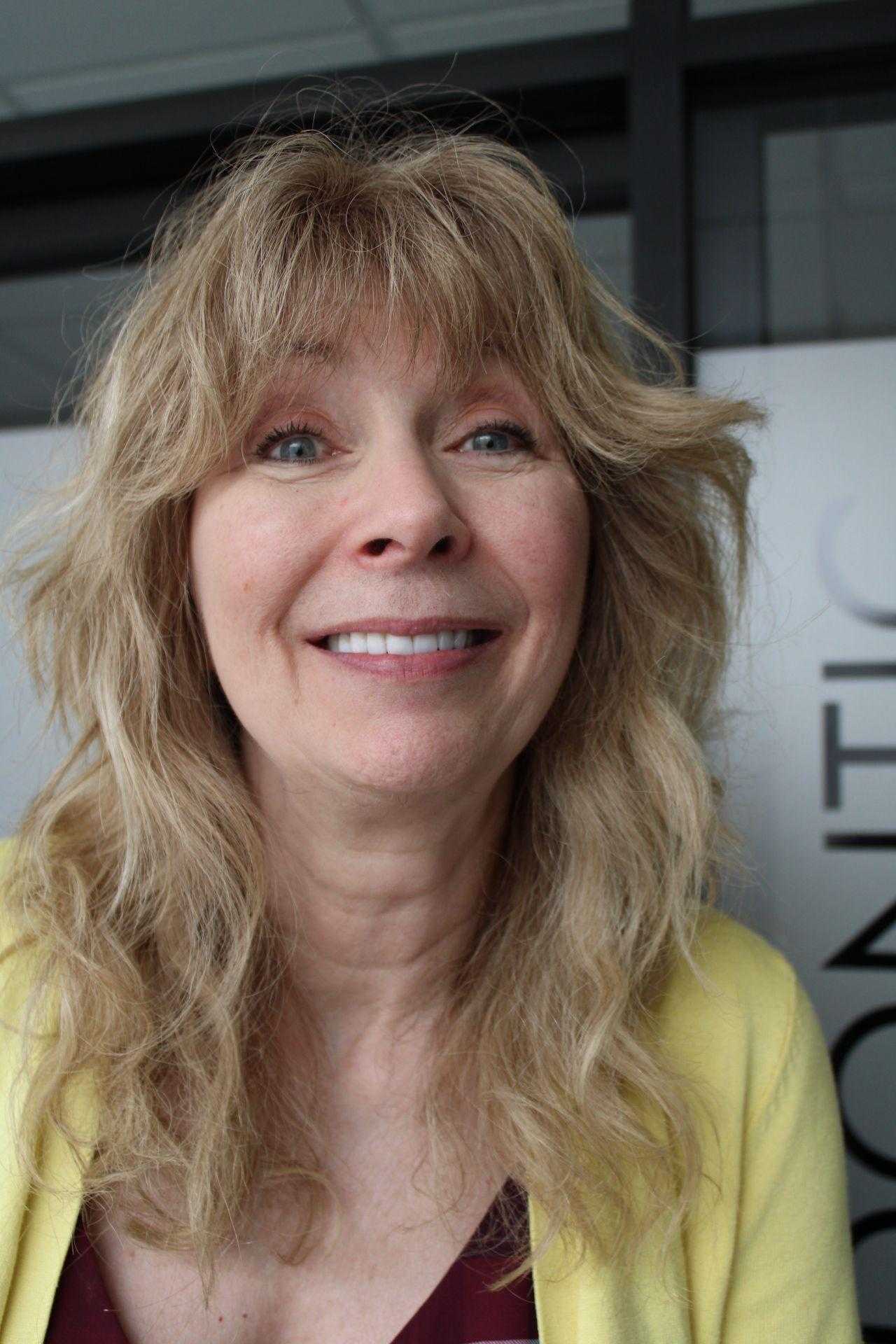 Dental Veneers in Los Algodones Mexico 