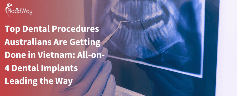澳大利亚人在越南接受的顶级牙科手术：All-on-4 种植牙引领潮流