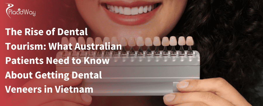 The Rise of Dental Tourism: What Australian Patients Need to Know About Getting Dental Veneers in Vietnam 