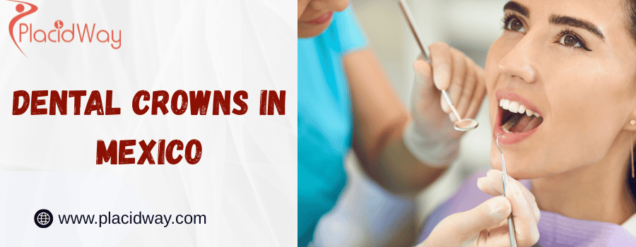 Dental Crowns In Mexico