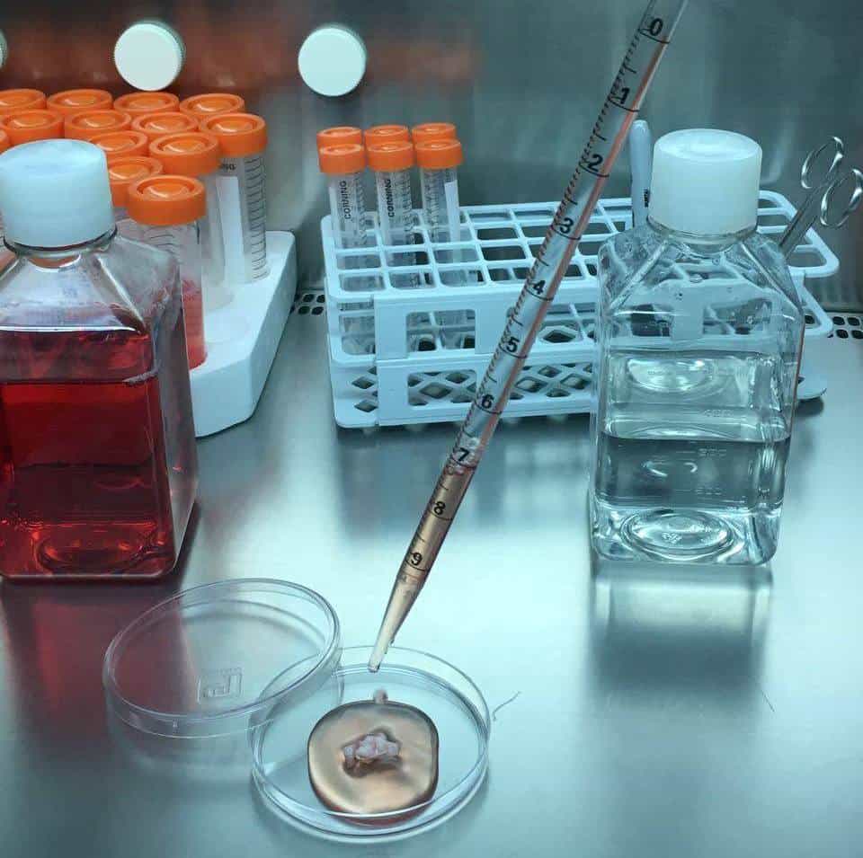 Clínica de terapia con células madre en México