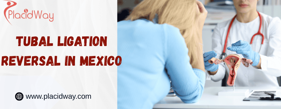 Reversión de la ligadura de trompas en México