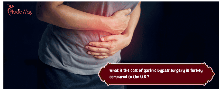 gastric bypass surgery in Turkey compared to the U.K