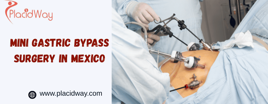 mini gastric bypass surgery in mexico