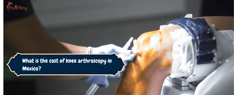 cost of knee arthroscopy in Mexico