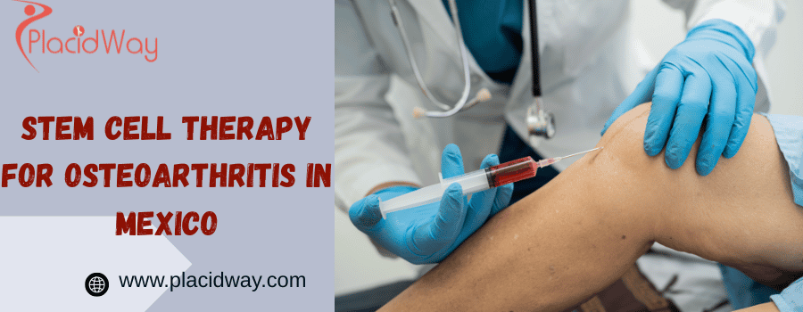Terapia con células madre para la osteoartritis en México