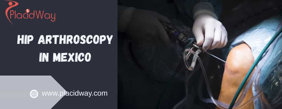 costo de la artroscopia de cadera en México