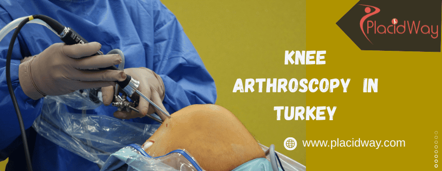 knee arthroscopy in Turkey