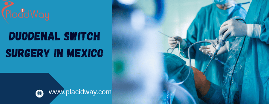 Duodenal Switch surgery in Mexico