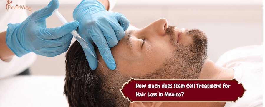 Stem Cell Treatment for Hair Loss in Mexico