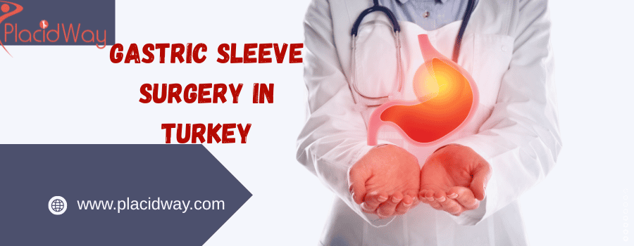 gastric sleeve 