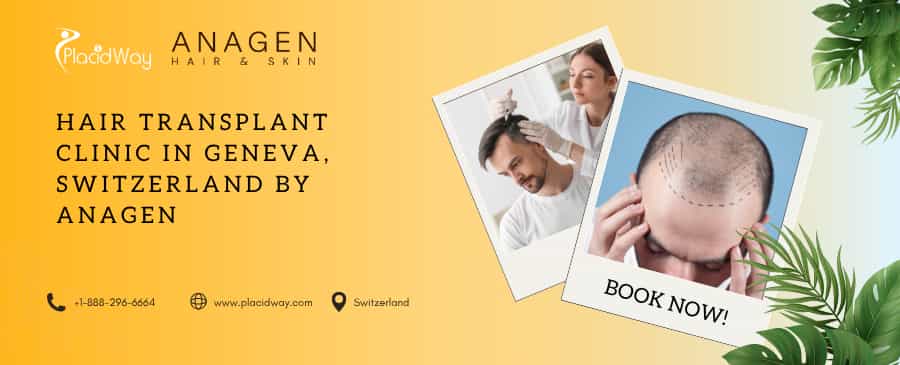 Clínica de trasplante capilar en Ginebra, Suiza, de Anagen