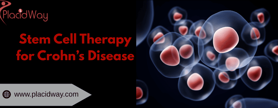 Terapia con células madre para la enfermedad de Crohn