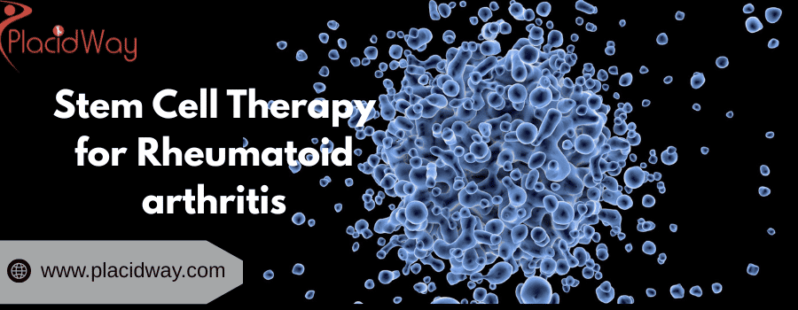 Terapia con células madre para la artritis reumatoide