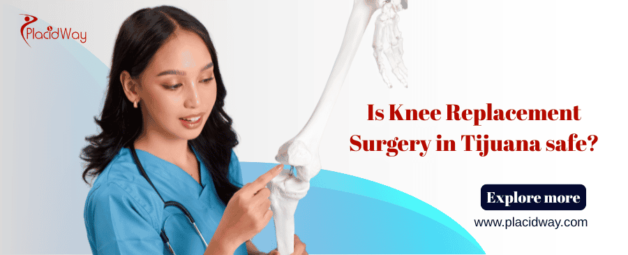 Is Knee Replacement Surgery In Tijuana Safe