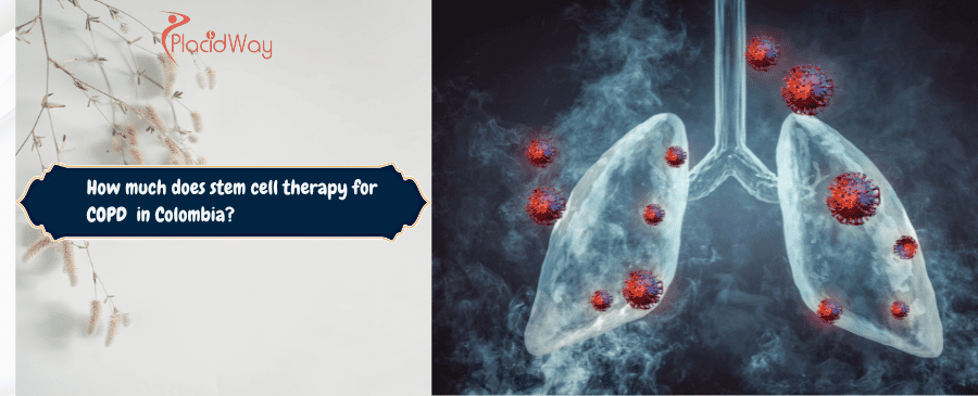 Terapia con células madre para la EPOC en Colombia