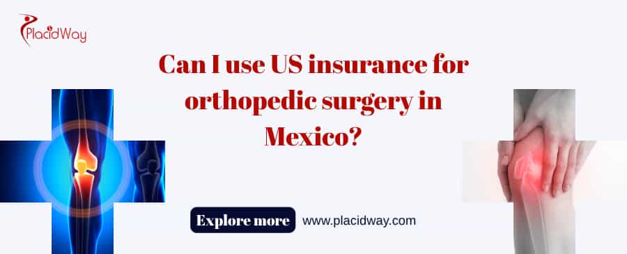 Can I Use Us Insurance For Orthopedic Surgery In Mexico