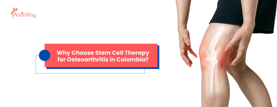 Terapia con células madre para la osteoartritis en Colombia