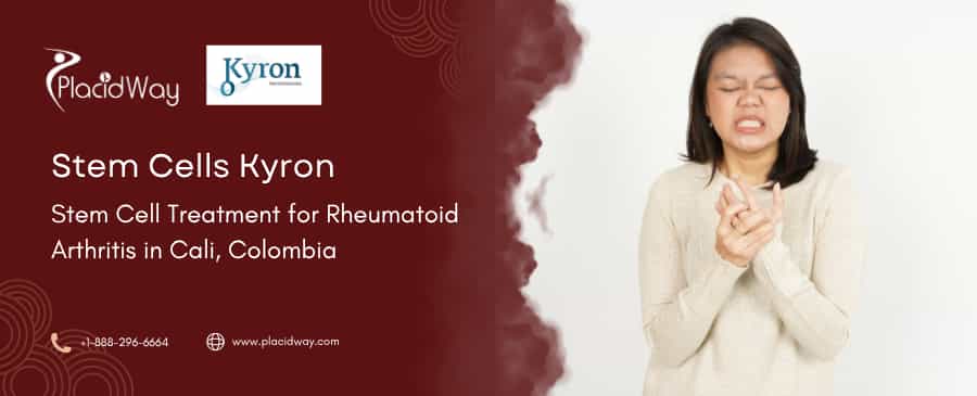 Tratamiento con células madre para la artritis reumatoide en Colombia
