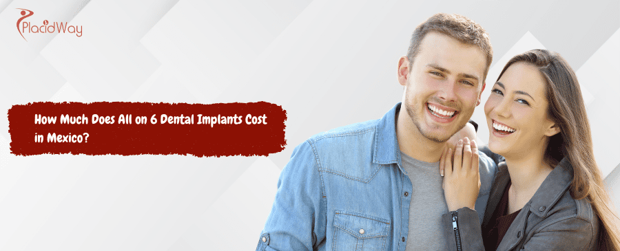 All on 6 Dental Implants Cost in Mexico