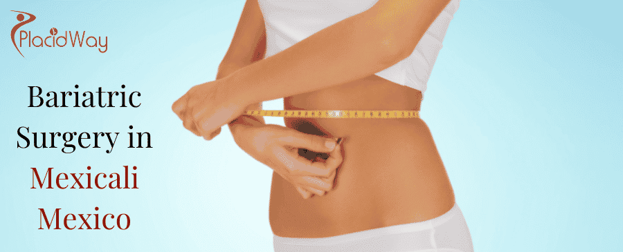Bariatric Surgery in mexicali