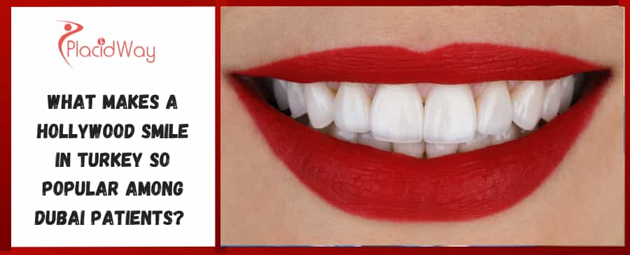 What Makes a Hollywood Smile in Turkey So Popular Among Dubai Patients 