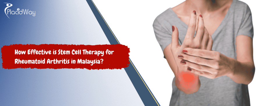 Stem Cell Therapy para sa Rheumatoid Arthritis sa Malaysia