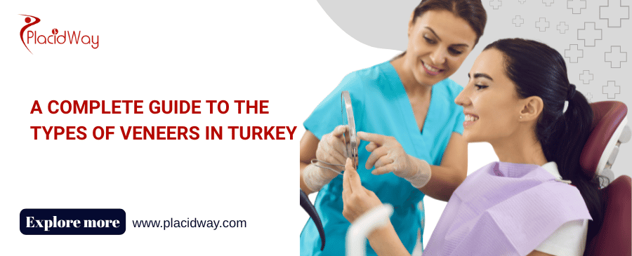 Ein vollständiger Leitfaden zu den Furnierarten in der Türkei