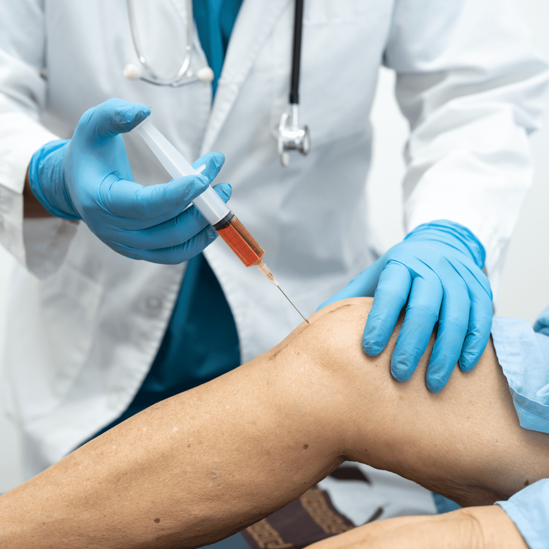 Tratamiento de la osteoartritis con células madre en Alemania