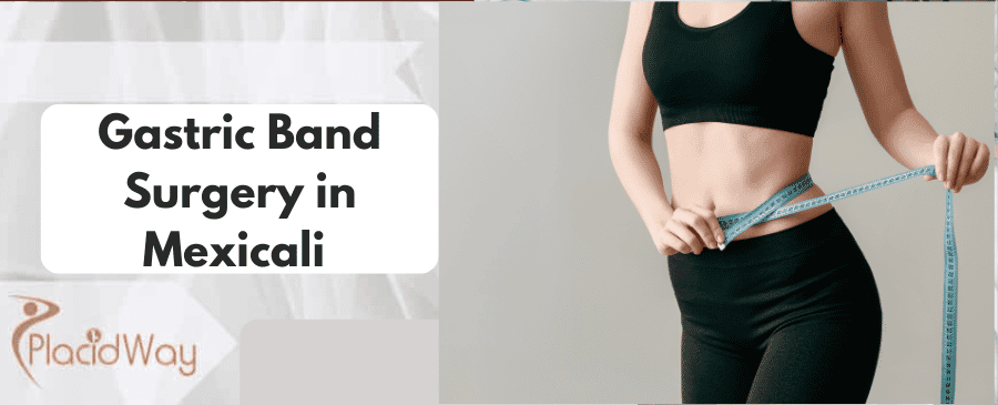 Gastric Band Surgery in Mexicali 