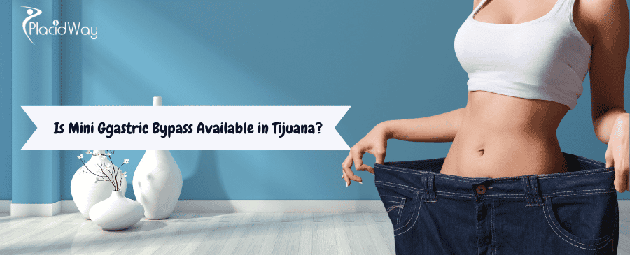 Mini bypass gástrico en Tijuana