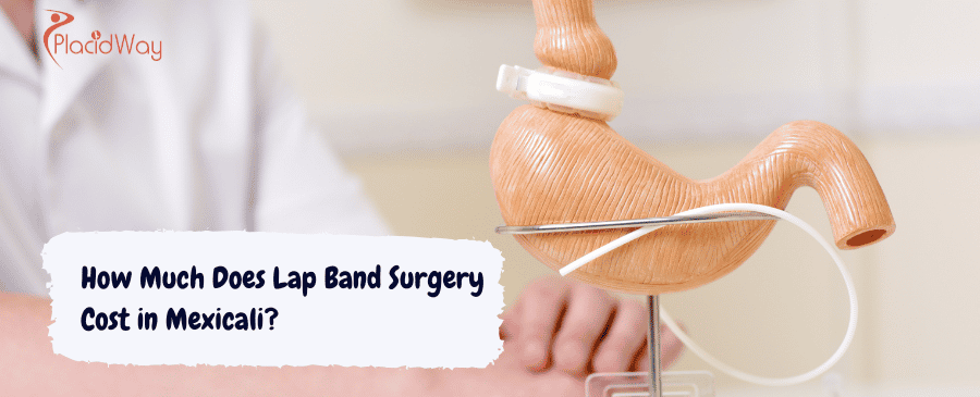 Lap Band Surgery Cost in Mexicali